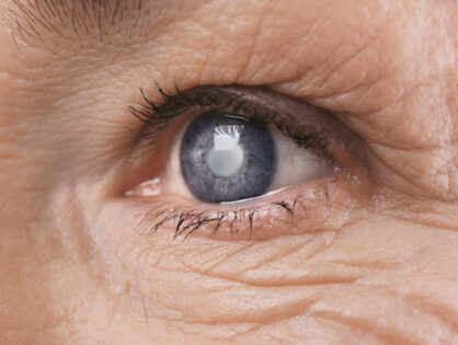 Πότε αποκαθίσταται η όραση μετά από εγχείρηση καταρράκτη;