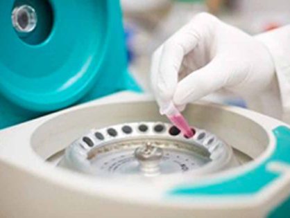 Τι είναι οι οφθαλμικές σταγόνες αυτόλογου ορού και που χρησιμοποιούνται