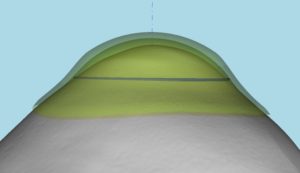 Κωνσταντίνος Καραμπάτσας Χειρούργος οφθαλμίατρος