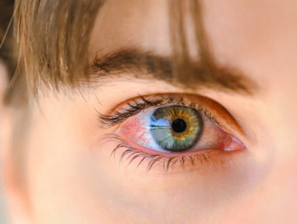 Συμπτώματα στα μάτια που απαιτούν άμεσο έλεγχο