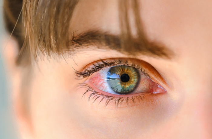 Συμπτώματα στα μάτια που απαιτούν άμεσο έλεγχο